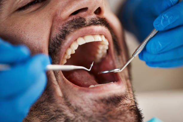 Professional Emergency Dental Service in NJ